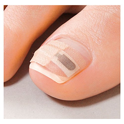 Ingrown Toenail lift tape Makizume Fix Prevention Supporters Foot 8-4134-01 NEW_2