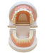 Dental Model Implant Bridge Dentist Research Explanation Small Size Pink NEW_1